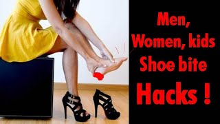 புது செருப்பு கடிக்காமல் இருக்க பல டிப்ஸ்/Slipper Bite Hacks