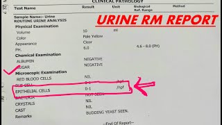 Urine Epithelial cells in Urine R/M report 🌟🌟/ video 247