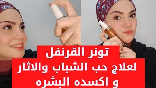 اقوي تونر طبيعي نضاره تفتيح علاج حب الشباب والاثار واكسدت البشره