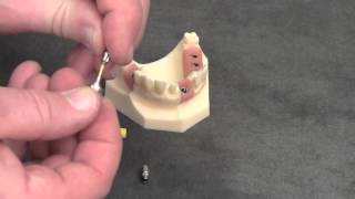 Snappy Abutment Tutorial