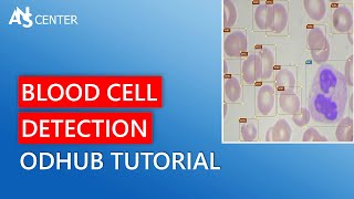 ODHUB Tutorial - How To Design A Blood Cell Detection Model