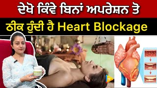 Heart Blo*ckage ਬਿਨਾਂ ਅਪ*ਰੇਸ਼ਨ ਤੋ ਕਿੰਵੇ ਠੀਕ ਹੁੰਦੀ ਹੈ ? ਦੇਖੋ