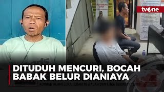 Dipaksa Mengaku Mencuri, Bocah 13 Tahun Dianiaya Ustaz Ponpes