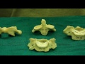 Vertebrae - How to differentiate them...