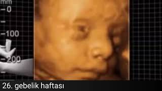 26 weeks baby in the womb smiling and opening eyes. - Dr. Kağan Kocatepe