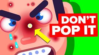 Why You Should NEVER Pop a Pimple