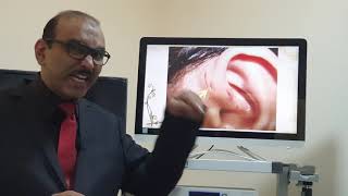 Preauricular sinus (Malayalam) Patient teaching programme