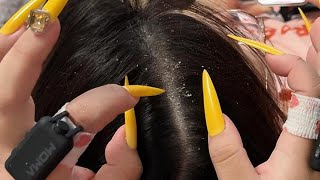 ASMR Long Nails Dandruff Cleaning & Deep Scalp Massage | No Talking Sleep Aid