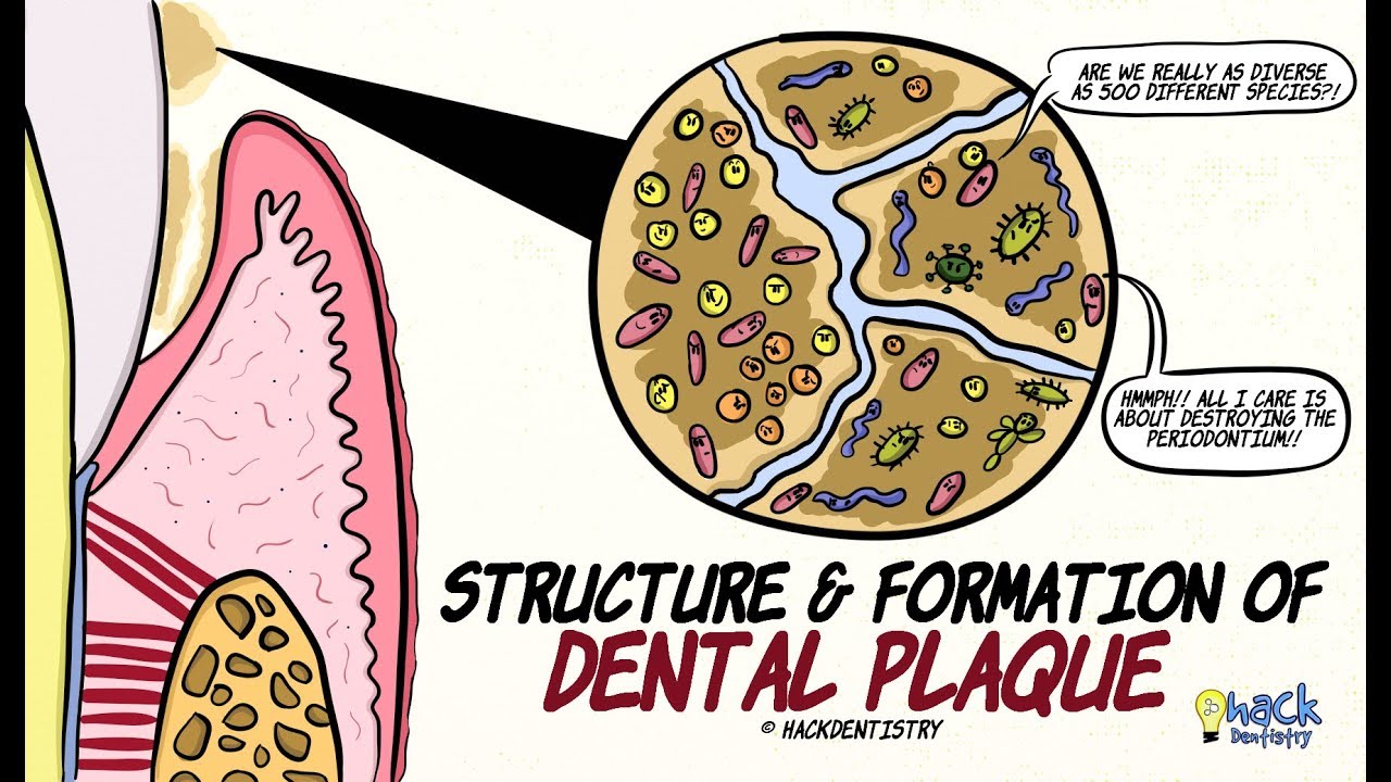 Dental Plaque Biofilm