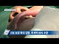 자궁·난소 초음파 건보 적용···연간 700만 명 혜택