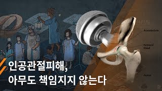 뉴스타파 - 존슨앤드존슨 인공관절피해, 아무도 책임지지 않는다