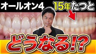 【症例解説シリーズ】15年経った オールオン４ どうなってるの？？