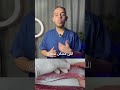 ديدان اللحوم واخطارها طب shorts food