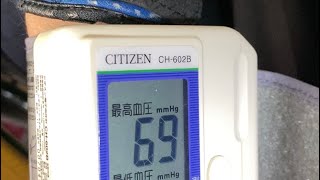 頸髄損傷の血圧