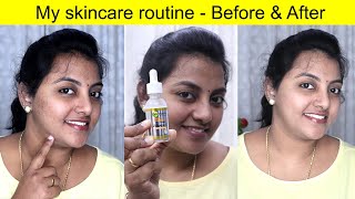 My skincare routine | How to use Garnier Vitamin C serum | Karthikha Channel Beauty Series