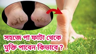 শীতে পা ফাঁটা? সরিষার তেল আর ভ্যাসলিনে সমাধান! / Winter Foot Care Tips /Cracked heels remedy