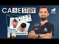 Case Study: 5300 Grafts Transformation by Dr. Mehmet Erdoğan | Hair Transplant Results