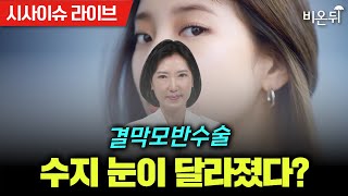 [시사이슈라이브] 수지 눈이 달라졌다? 결막모반수술 / 누네안과병원 한혜경