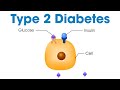 Type 2 Diabetes – What Is It? | Munson Minutes