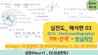 심전도_ 해석편 03 : 'PR-간격' & '방실차단(AV block)'  이해하기 (1도 방실차단/ 2도 방실차단(Mobitz I, II)/ 3도 방실차단