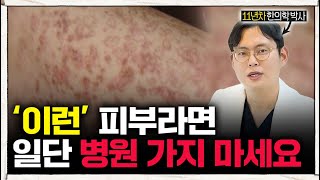 낫기 힘든 피부질환, ‘이것’ 하나만 조절해보세요. [피부질환, 한공각화증] l #한의학박사