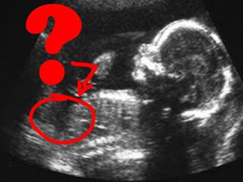 Is Your Baby a Boy or a Girl? (Pregnancy Health Guru) Is Your Baby a Boy or a Girl? (Pregnancy Health Guru)