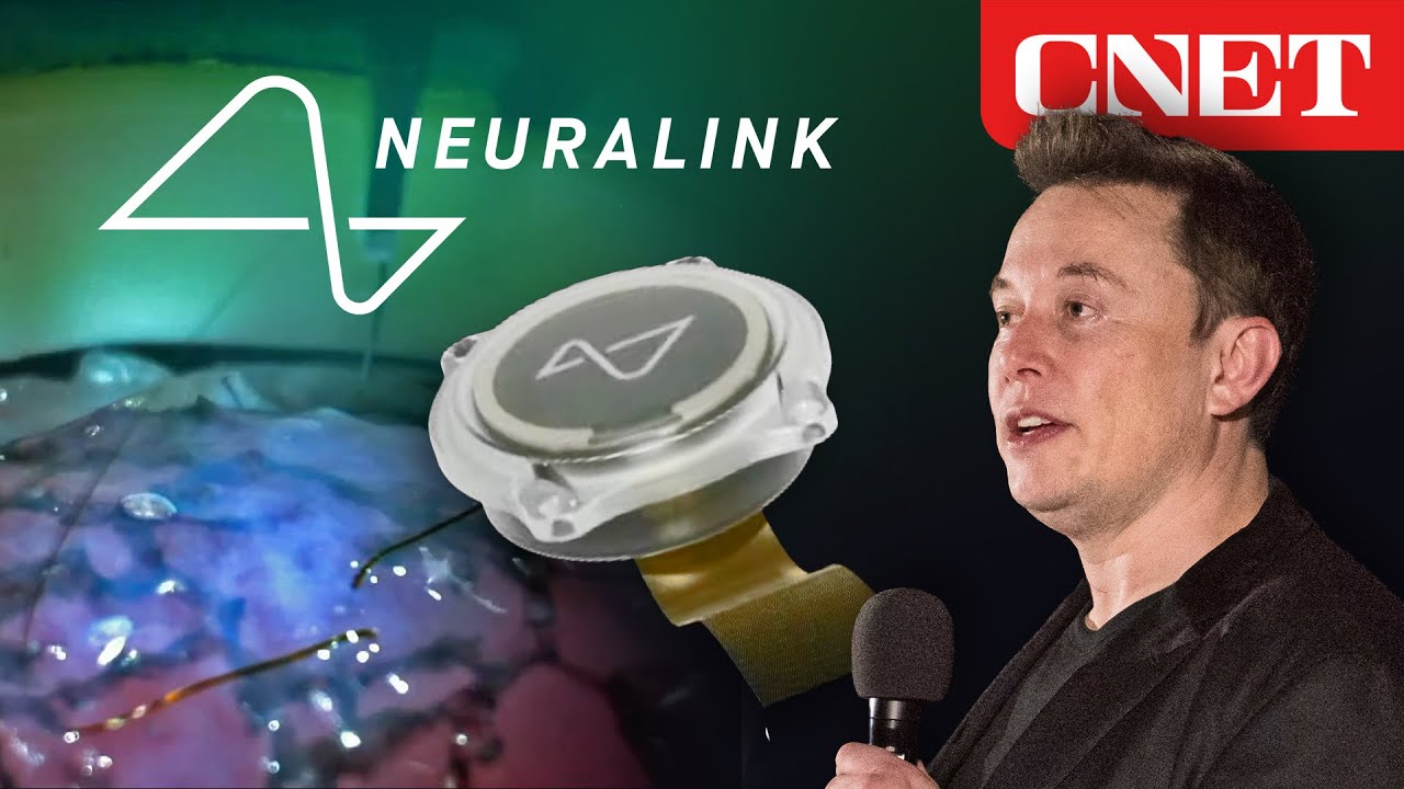 Elon Musk’s Neuralink Event: Everything Revealed in 10 Minutes