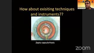 AIOC2021-GP59-Topic-Dr. Isha Gupta-Dented cystitome  Realtime capsulorhexis measurement