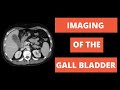 How to Image the Gallbladder - Ultrasound, CT, MRI, HIDA Basics