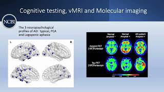 FAQ: Can the diagnosis of Alzheimer’s disease be confirmed in the living patient?