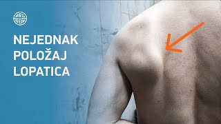 Nejednak položaj lopatica | PROGEIN 2021