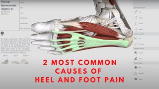 2 MOST COMMON CAUSES OF HEEL AND FOOT PAIN | Orthopedic \u0026 Balance Therapy Specialists | OBTS