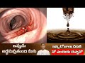 Heart Attack Risks | Addiction of Tea and Coffee | Improves Infertility | Dr. Manthena's Health Tips