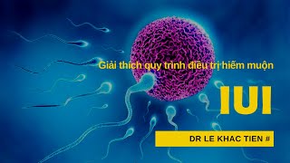 #52 Giải thích cách kích trứng và bơm tinh trùng vào buồng tử cung (thụ tinh nhân tạo/IUI)