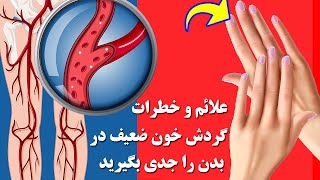 گردش خون ضعیف باعث چه اتفاقاتی در بدن ما خواهد شد و چگونه باید درمان شود ؟