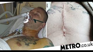 Cancer patient shows effects of smoking 300,000 cigarettes in a lifetime