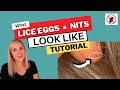 What Lice Eggs and Nits Look Like Video Tutorial