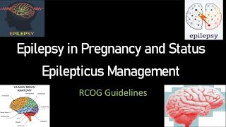 Epilepsy in Pregnancy and Status Epilepticus Management, RCOG Guideline