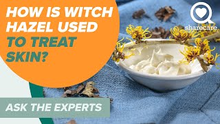 How is Witch Hazel Used to Treat Skin? | Ask The Experts | Sharecare