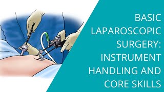 Basic Laparoscopic Surgery: Instrument Handling and Core Skills