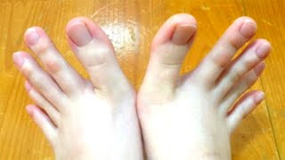 This Woman’s Feet Has Left The Entire World Obsessed – Only 1 In 13 Have Them!