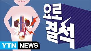 요로결석 / YTN