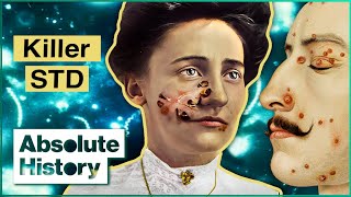 Death By Syphilis: The Real Origins Of The Killer Infection | Syphilis Enigma | Absolute History