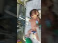 newbornbaby ventilator out when circuit support nicu