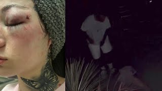 Bhad Bhabie POST & DELETES DISTURBING PHOTOS!