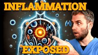 What Many People Don't Get About Inflammation