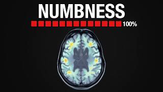 How Antidepressants Actually Work