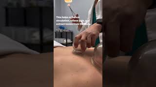 Fire Cupping: Would You Try This?