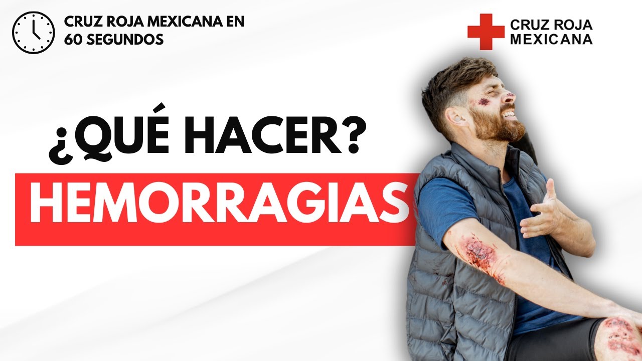 Qué Hacer En Caso De Hemorragia Primerosauxilios Youtube