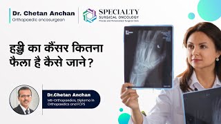 हड्डी का कैंसर कितना फैला है कैसे जाने?  | How to Do Workup of Bone Cancer? | Dr Chetan Anchan, SSO